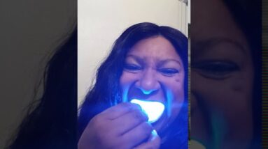 Snow teeth whitening system review