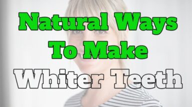 teeth whitening