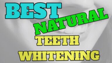 teeth whitening